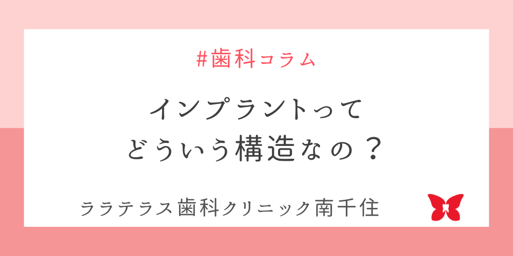 インプラントってどういう構造なの？